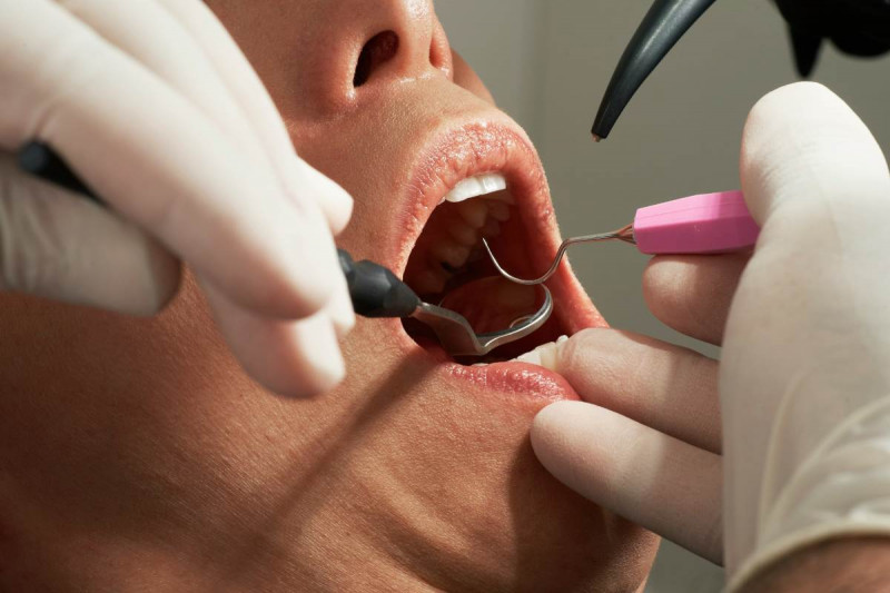How Long Does It Take to Become a Dental Hygienist?